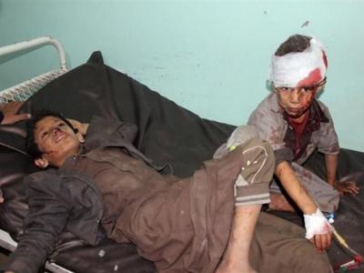 جدیدترین گزارش از وضعیت ناگوار کودکان یمنی/100 هزار کودک سالانه جان می بازند
