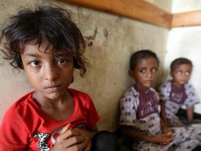 یمن| فوت سالانه 100 هزار کودک بر اثر محاصره ائتلاف سعودی