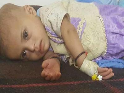 مرگ سالانه ۱۰۰ هزار کودک یمنی به دنبال اقدامات متجاوزان