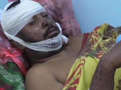 یمن| انصارالله مسئولیت حمله به اردوگاه مأرب را نپذیرفت